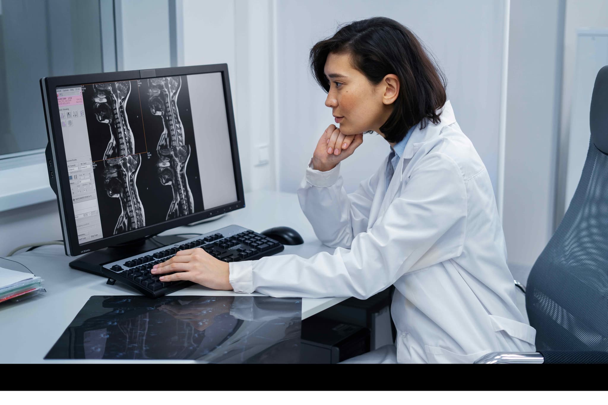 Spinal Fusion Surgery treatment