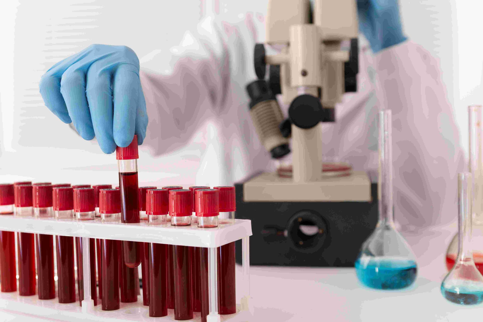 Hematology