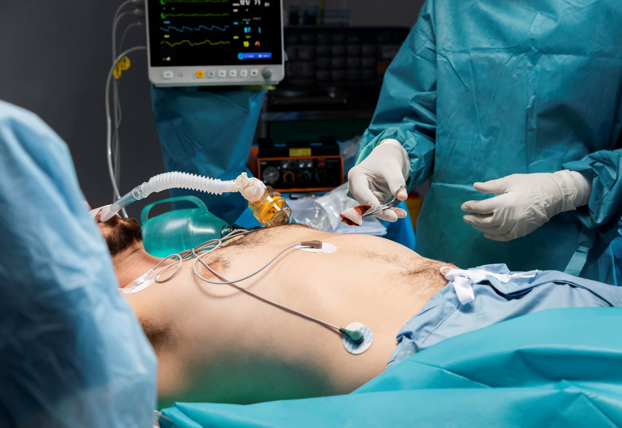 Appendectomy (Open/Laparoscopic) hospital