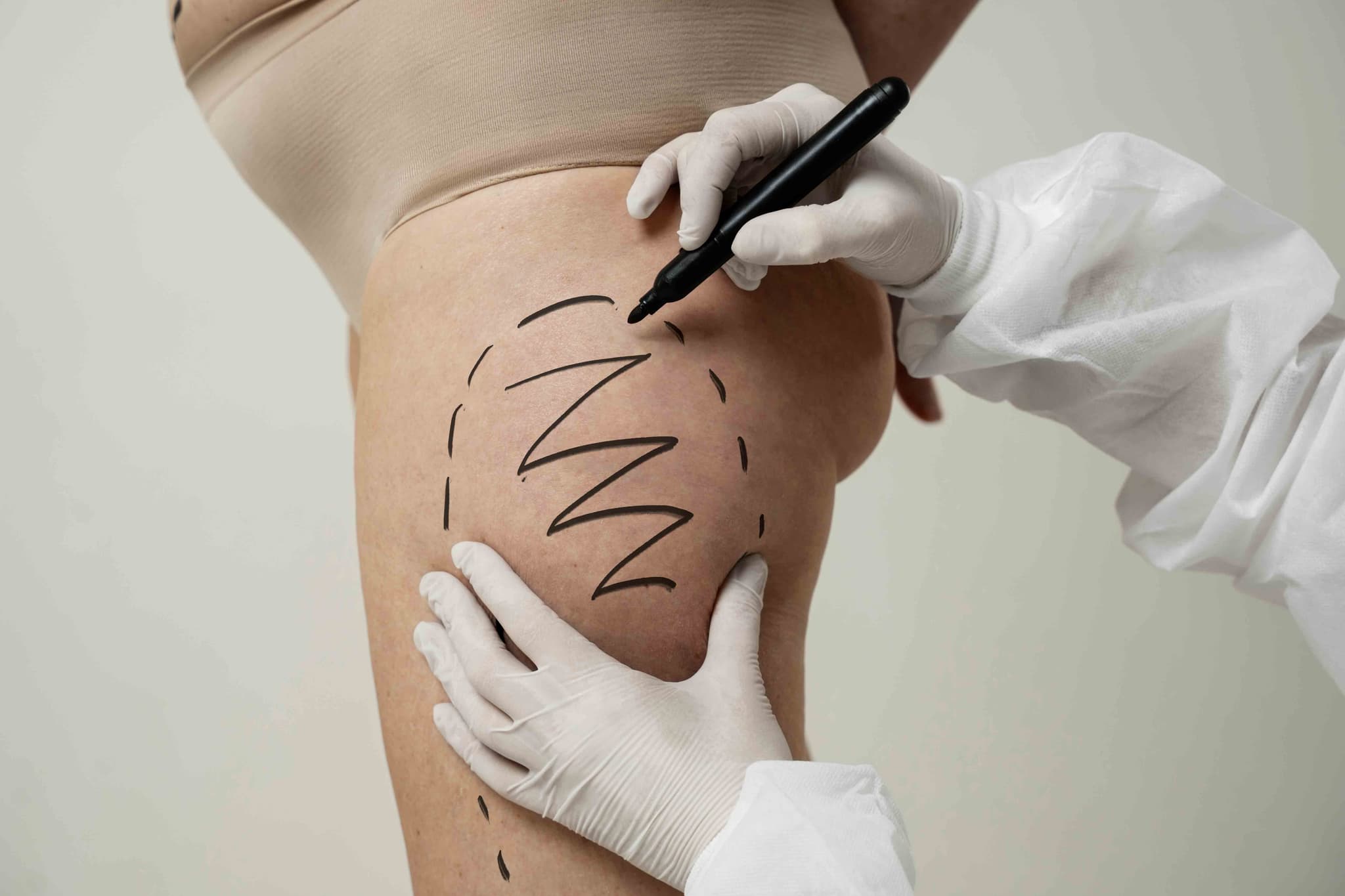 Thigh Lift Surgery hospital