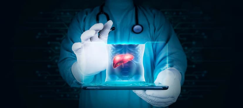Liver Biopsy