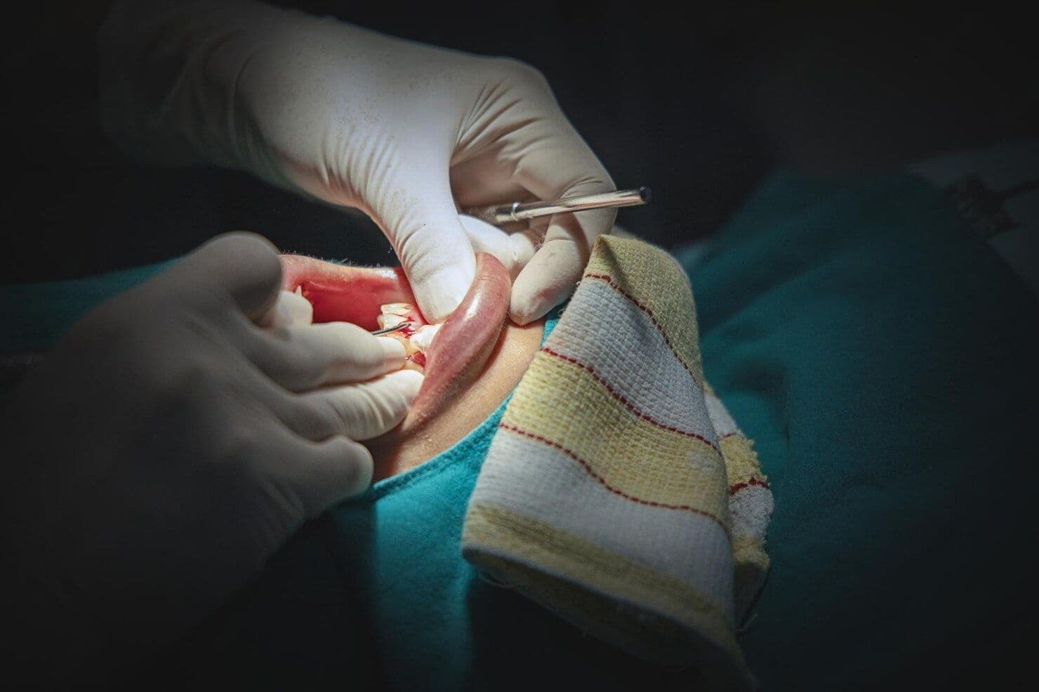 Polypectomy (Uterine Polyp Removal) hospital