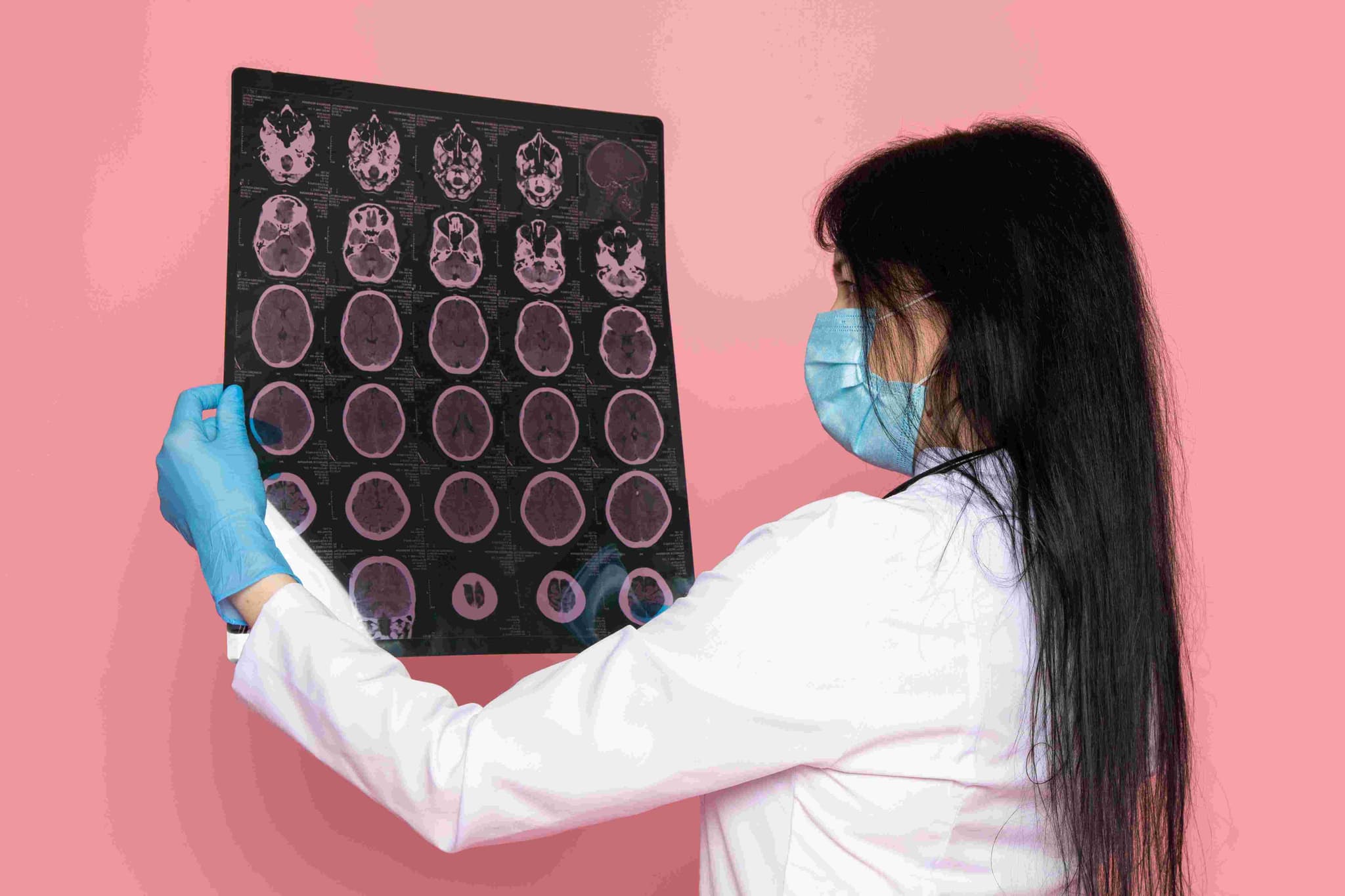 Endovascular Coiling hospital
