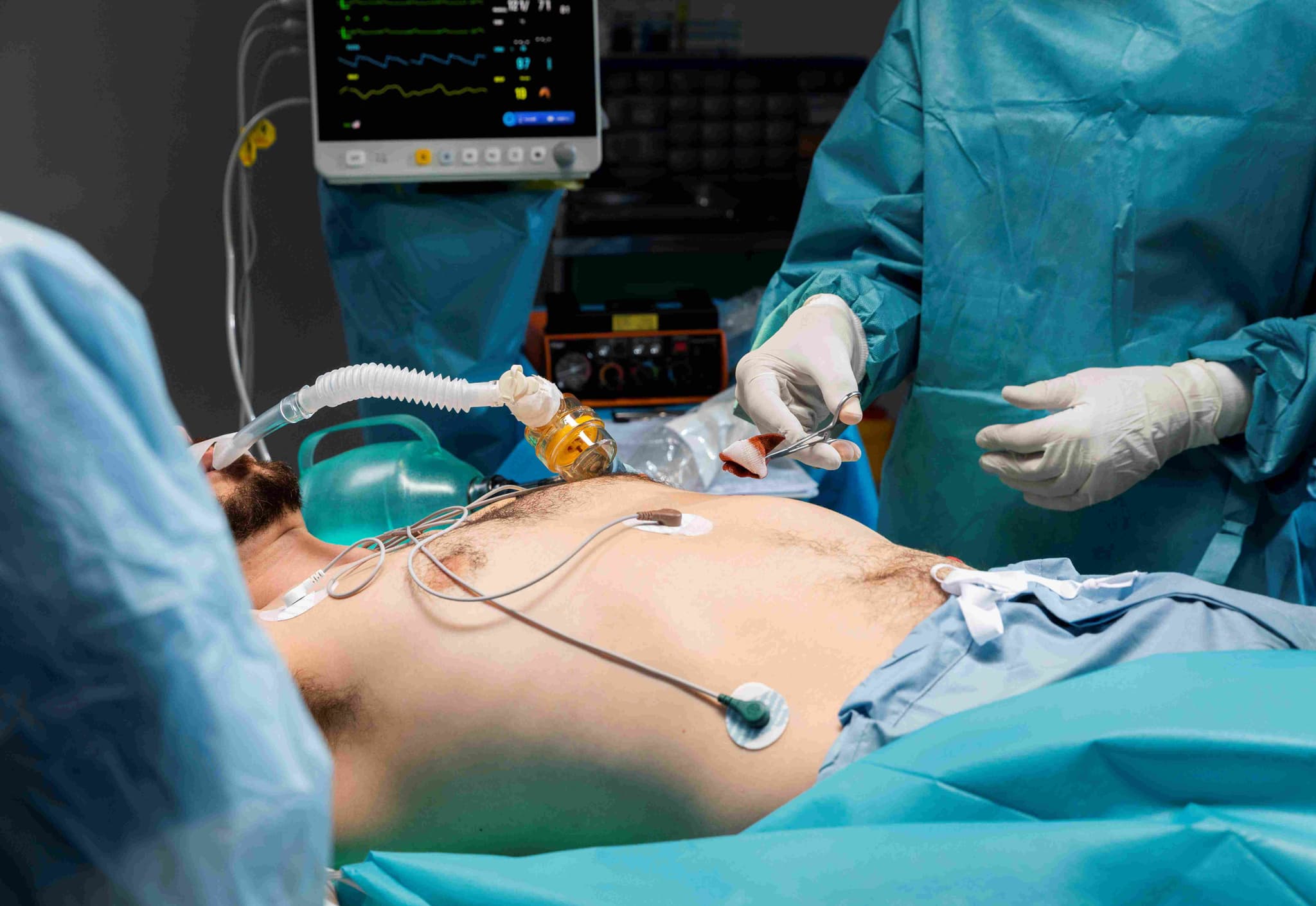 ECMO Cannulation hospital