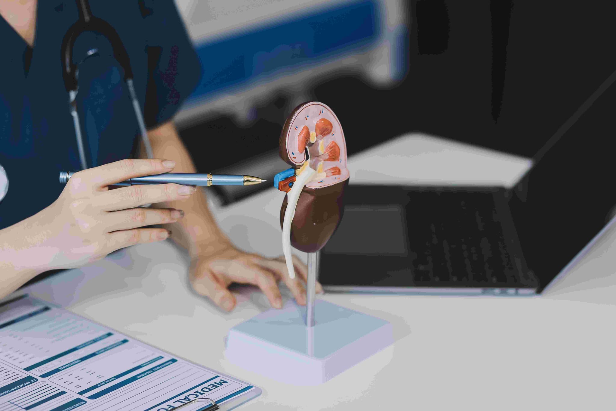 Kidney Function Test (KFT)