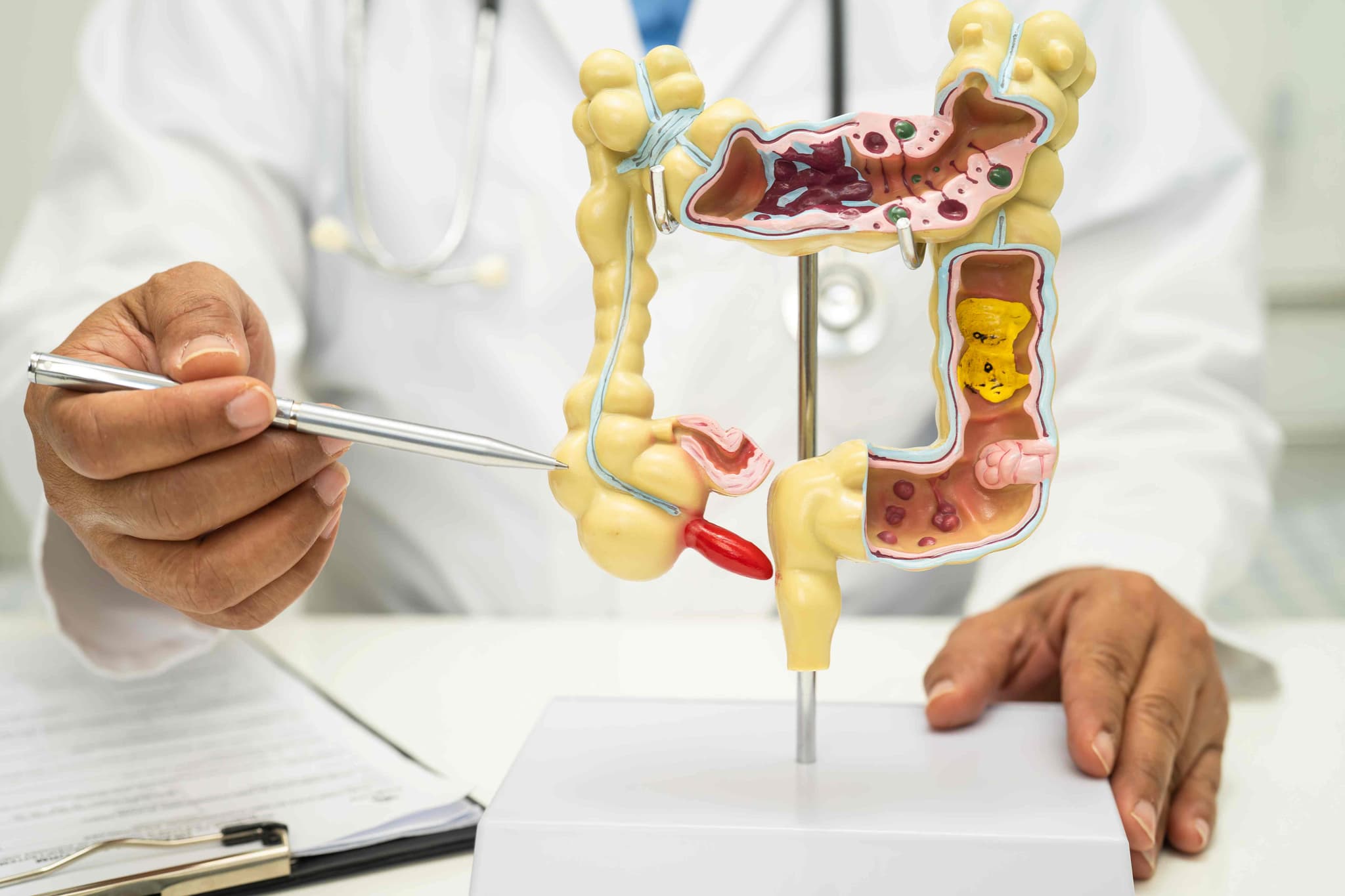 Colectomy (Colon Cancer) hospital