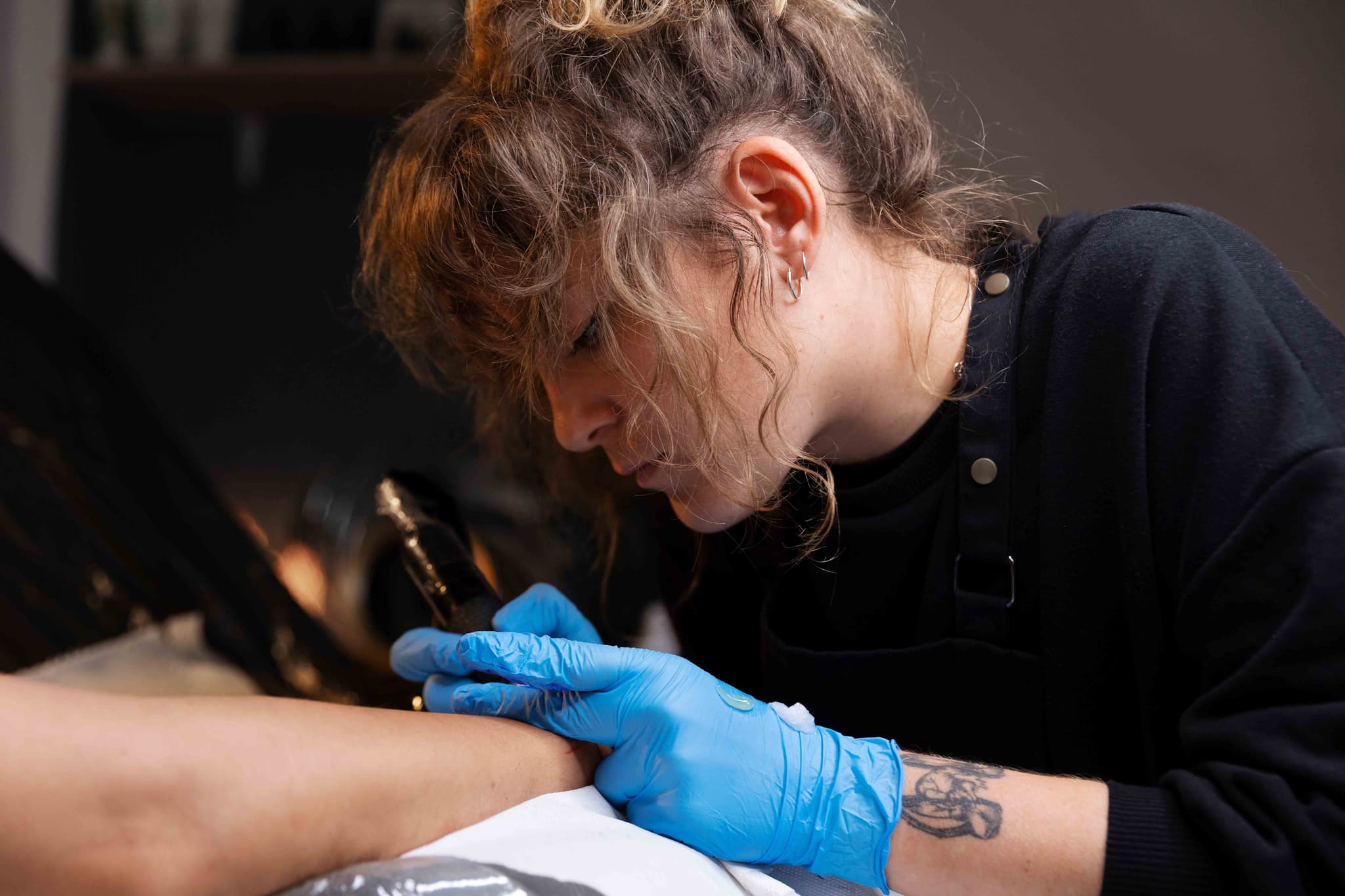 Tattoo Removal by Laser hospital