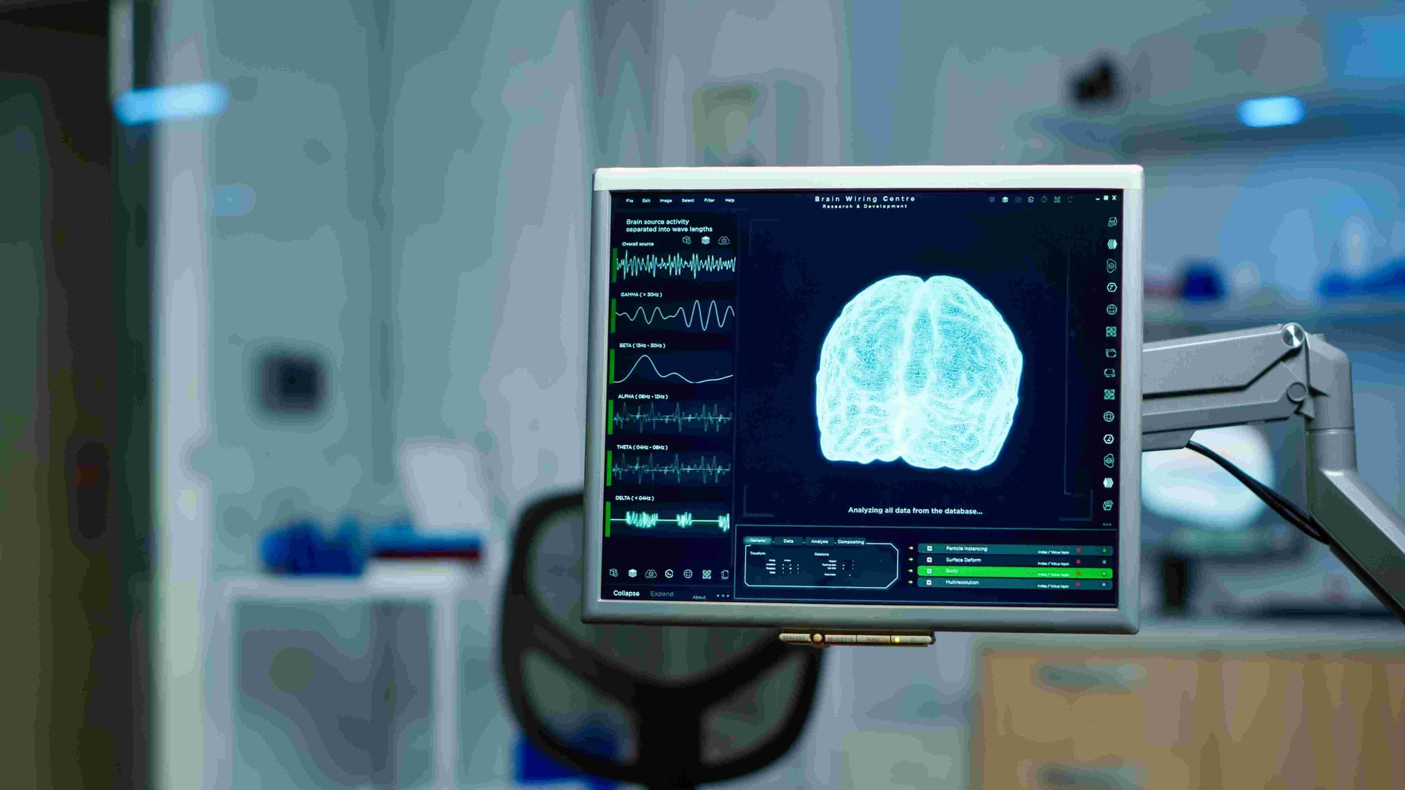 Intracranial Artery Stenting hospital