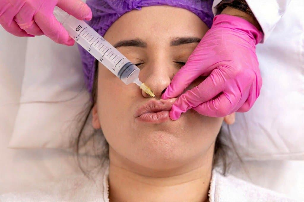 Injectable Filler / Lip Augmentation hospital
