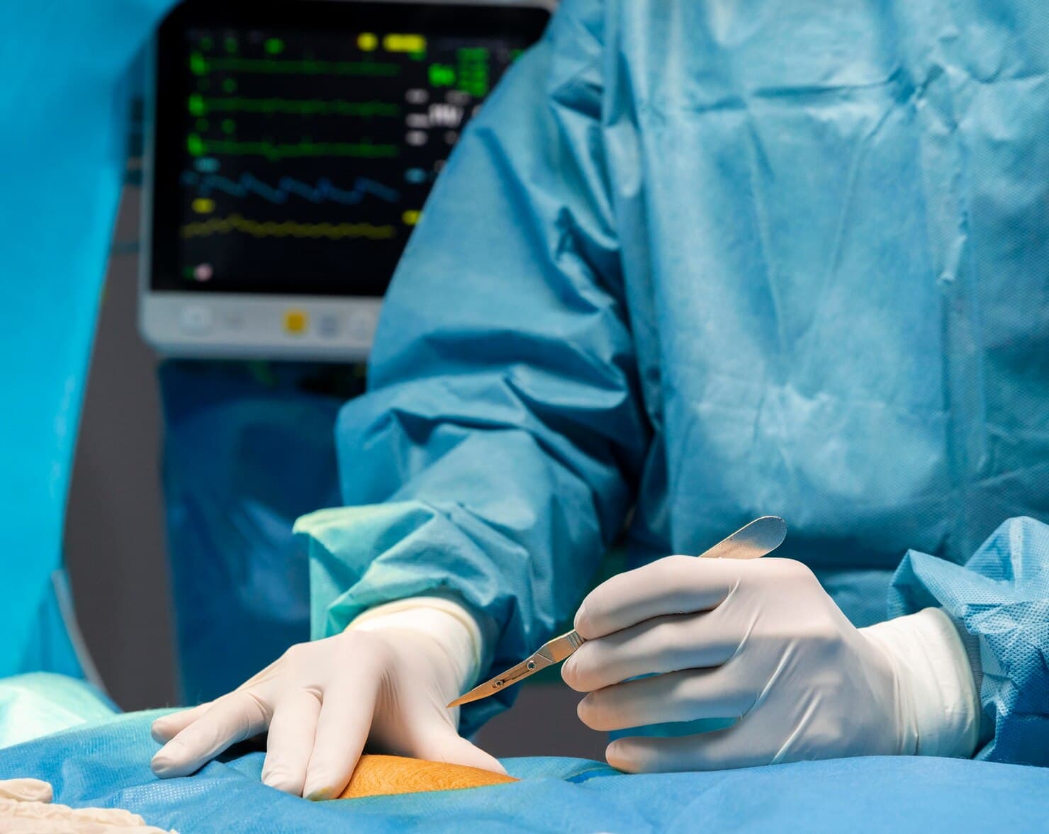 Mesh Hernioplasty hospital