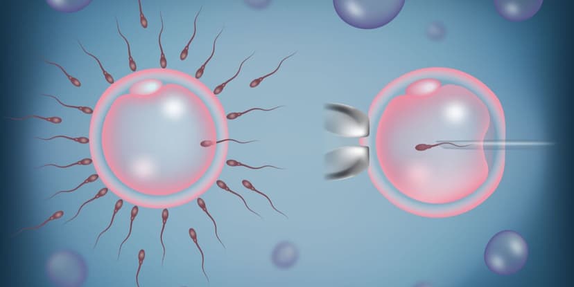 IVF with Intracytoplasmic Sperm Injection (ICSI)