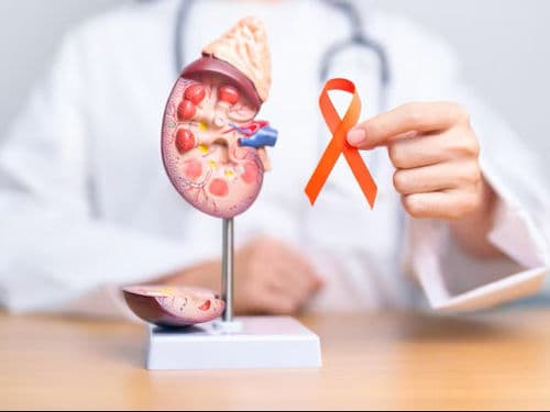 Kidney Cancer Treatment treatment