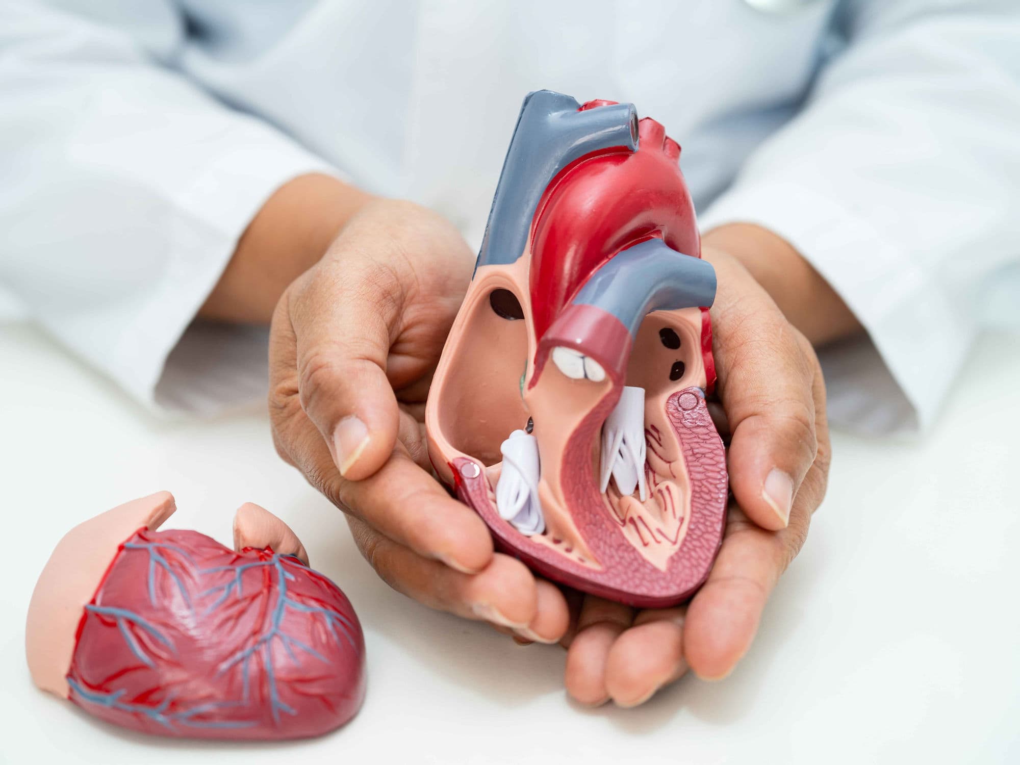TMVI/TMVR (Transcatheter Mitral Valve Replacement) treatment