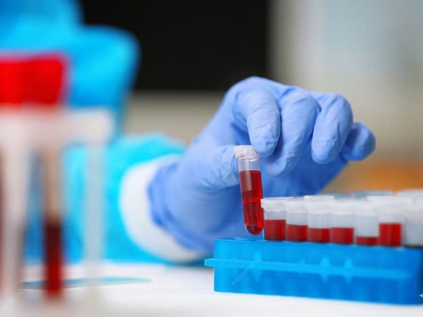 Peripheral Blood Stem Cell (PBSC) Harvesting treatment