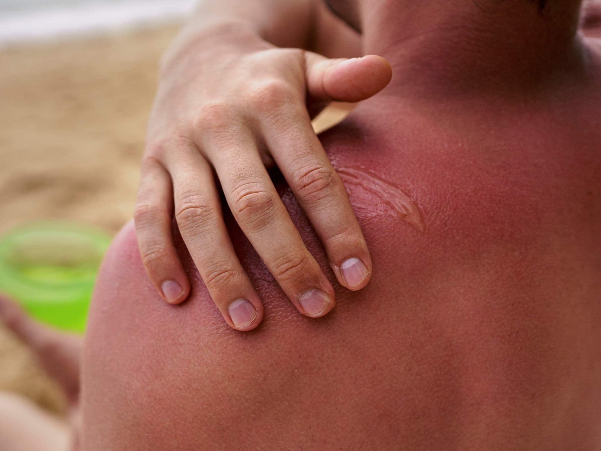 Debridement Surgery treatment