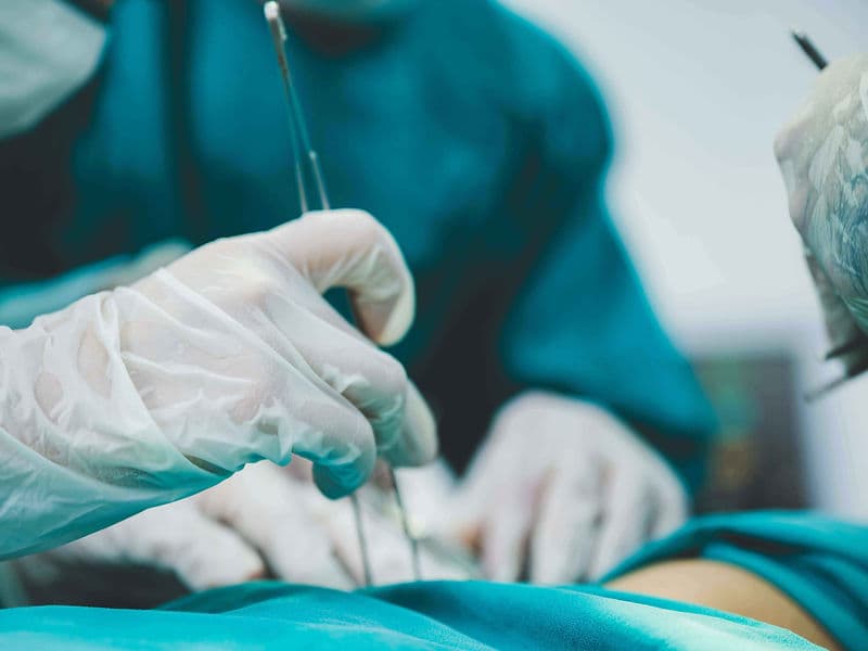 IVC Filter Placement