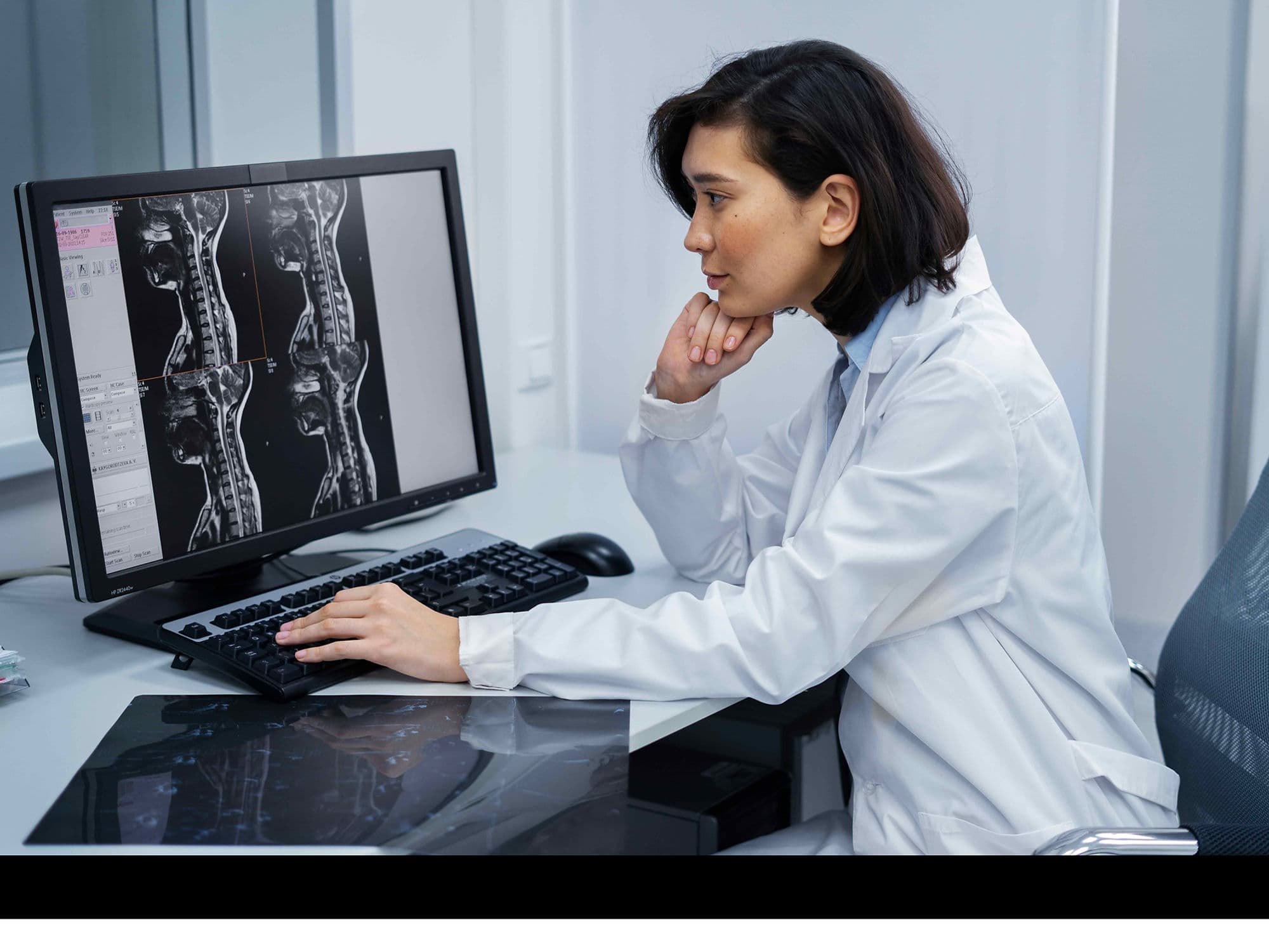 Spinal Fusion Surgery treatment