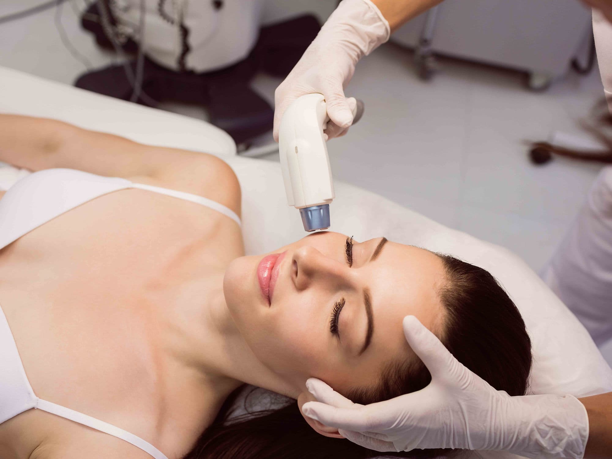 Laser Skin Resurfacing treatment