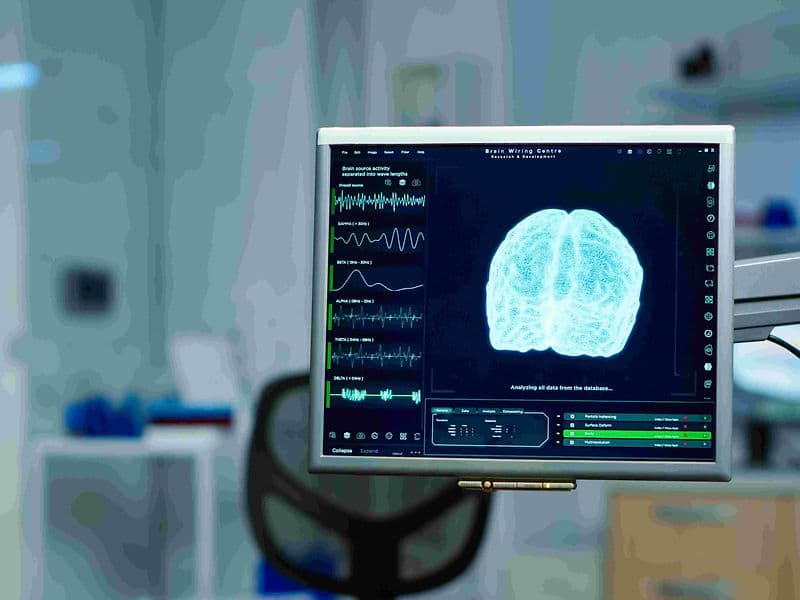 Intracranial Artery Stenting