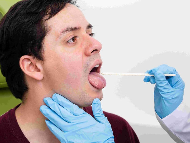 Uvulopalatopharyngoplasty (UPPP)