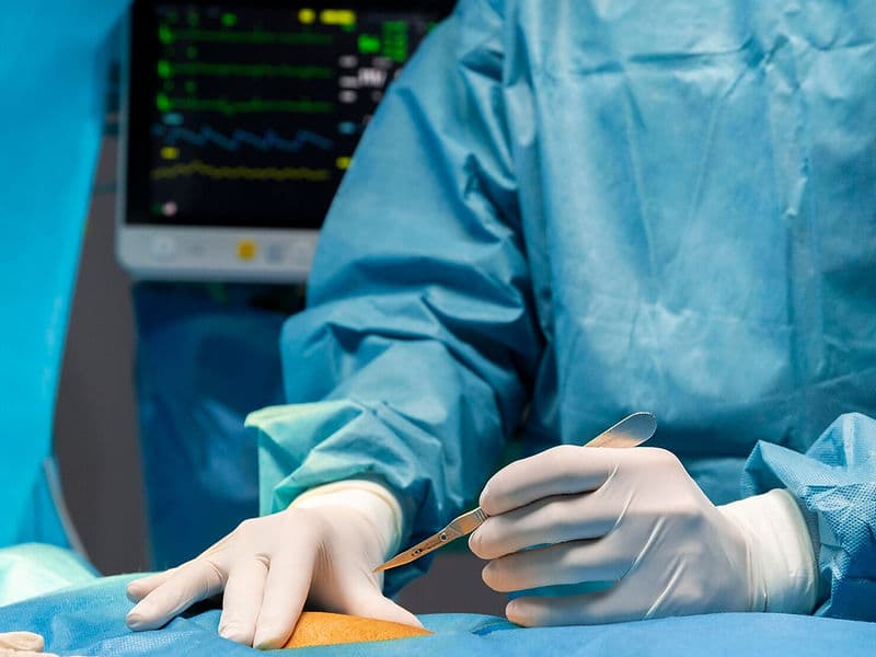 Ovarian Cyst Removal (Laparoscopic Cystectomy)