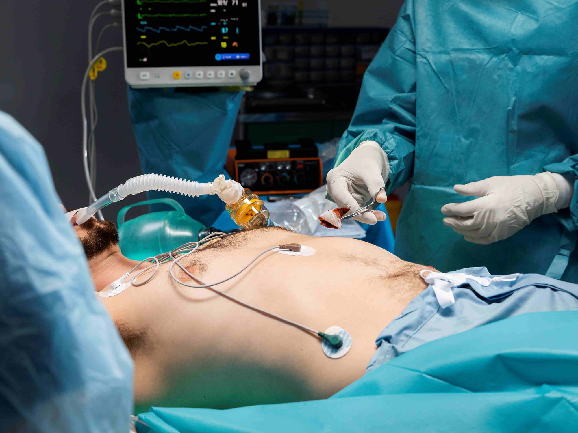 Loop Recorder Implantation treatment